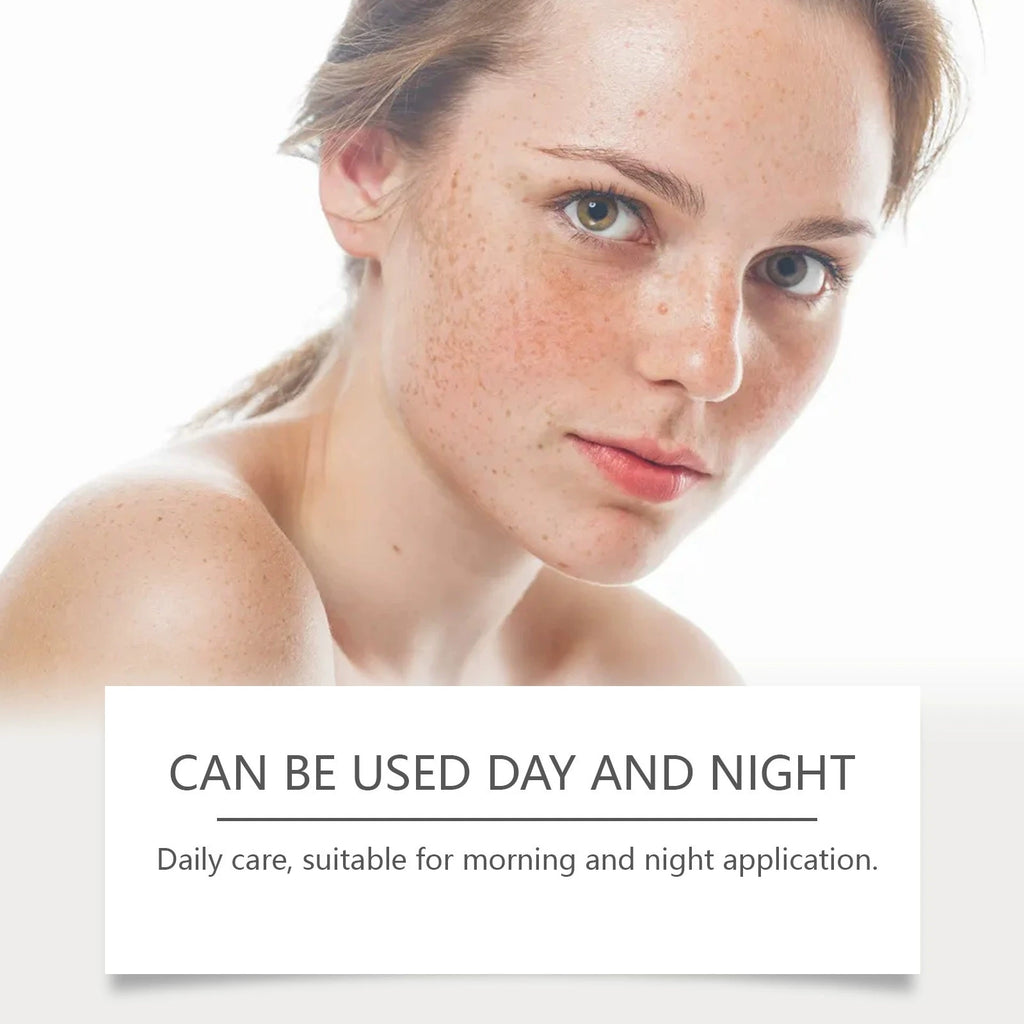 SADOER Anti Freckle Cream – Reduser pigmentflekker og få en jevn, strålende hudtone