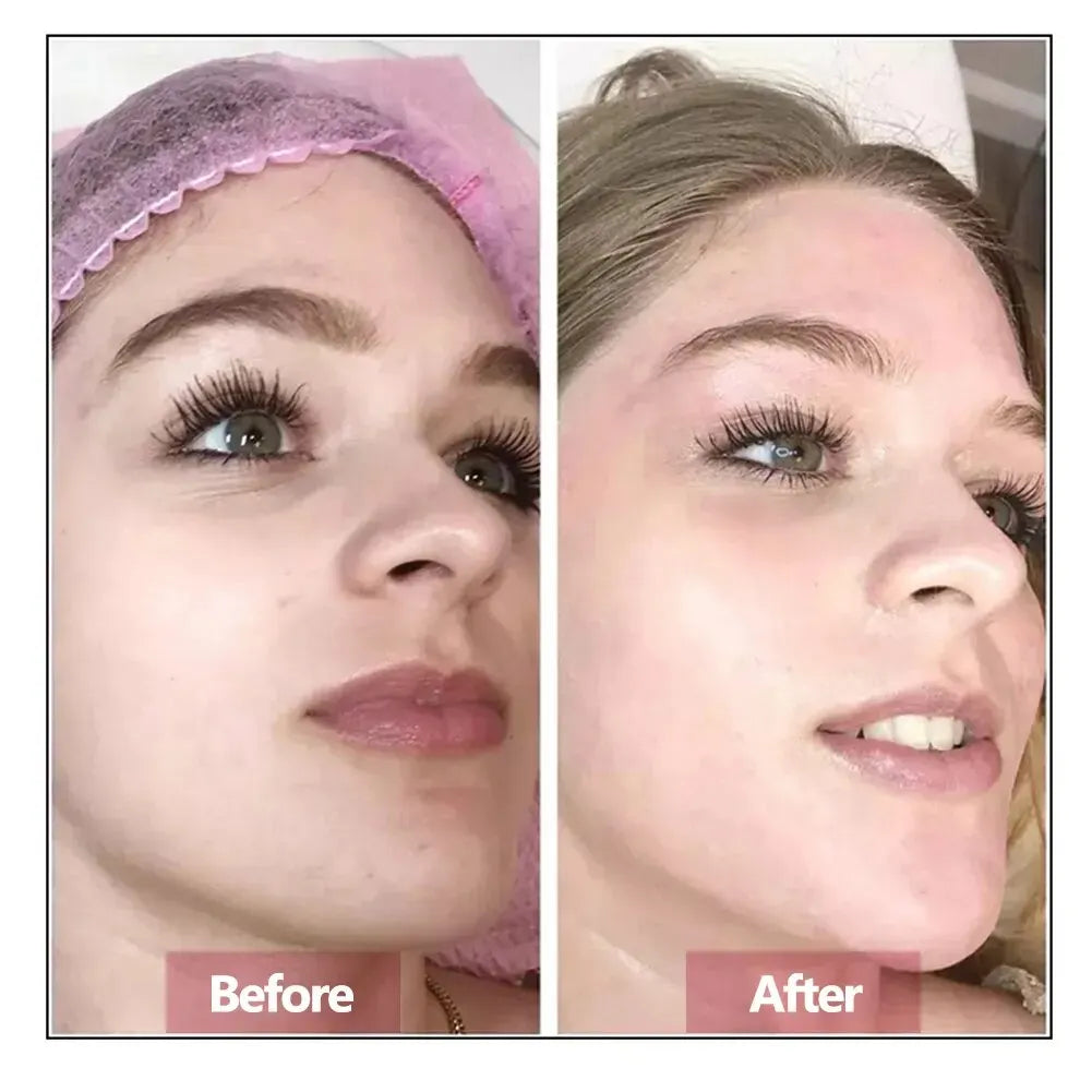 Hyaluronic Acid Face Serum – Dyp fukt, fasthet og fornyet glød