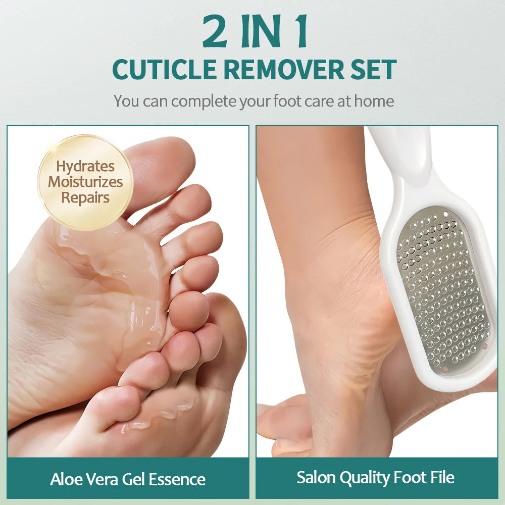 Nailpop Professional Callus Remover for Feet Extra Strength Gel & Rasp Foot File Kit Dead Skin Remover Cracked Heels Dry Skin