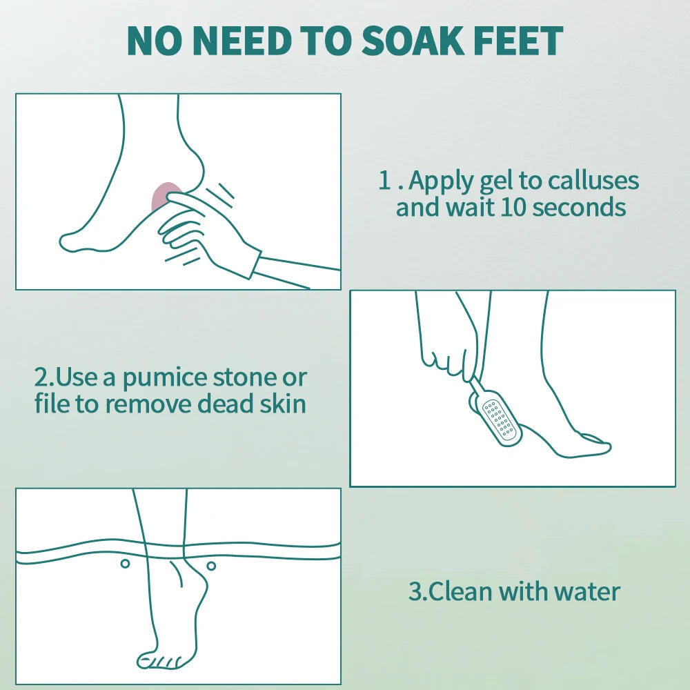 Nailpop Professional Callus Remover for Feet Extra Strength Gel & Rasp Foot File Kit Dead Skin Remover Cracked Heels Dry Skin