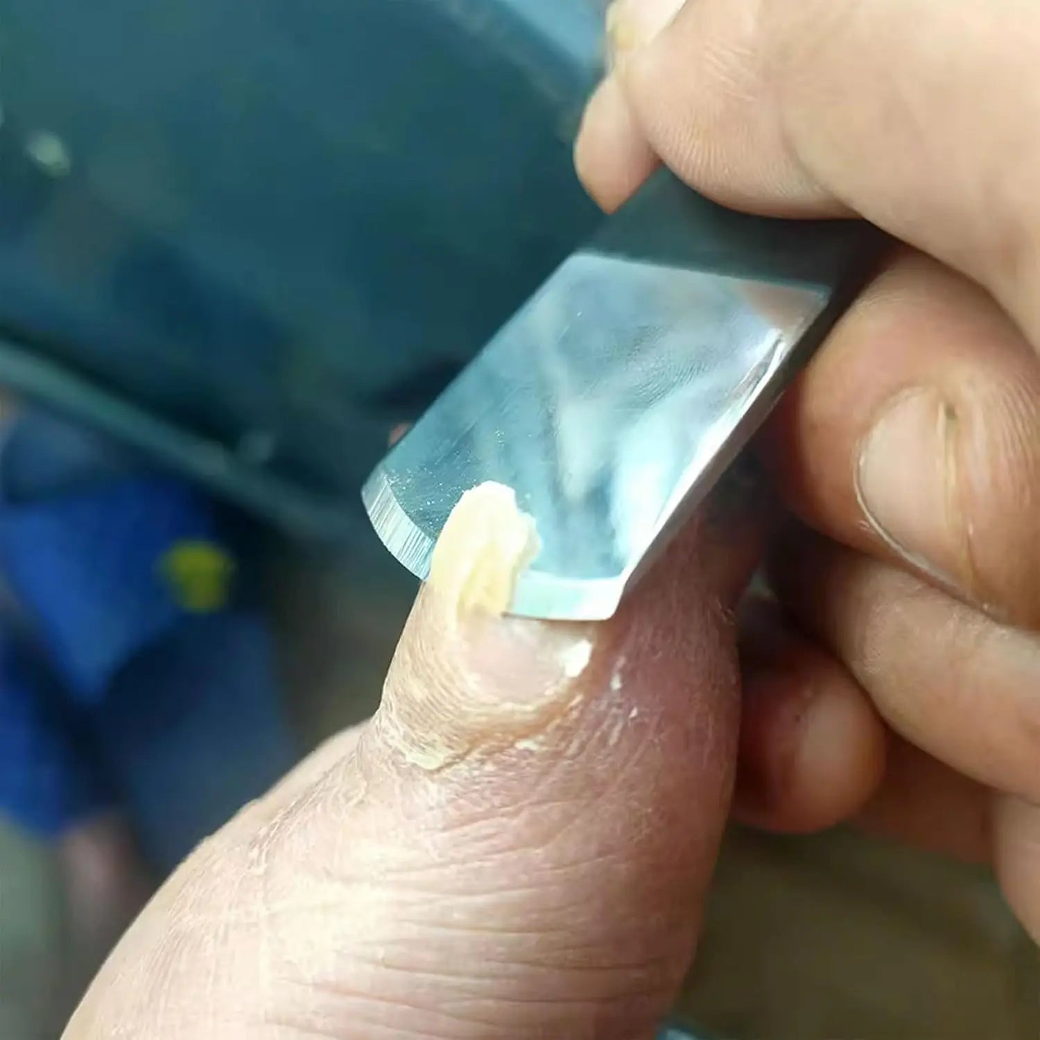 4/5/6/9 stk Pedikyrknivsett – Komplett Fotpleiesett i Rustfritt Stål for Hard Hud og Neglepleie