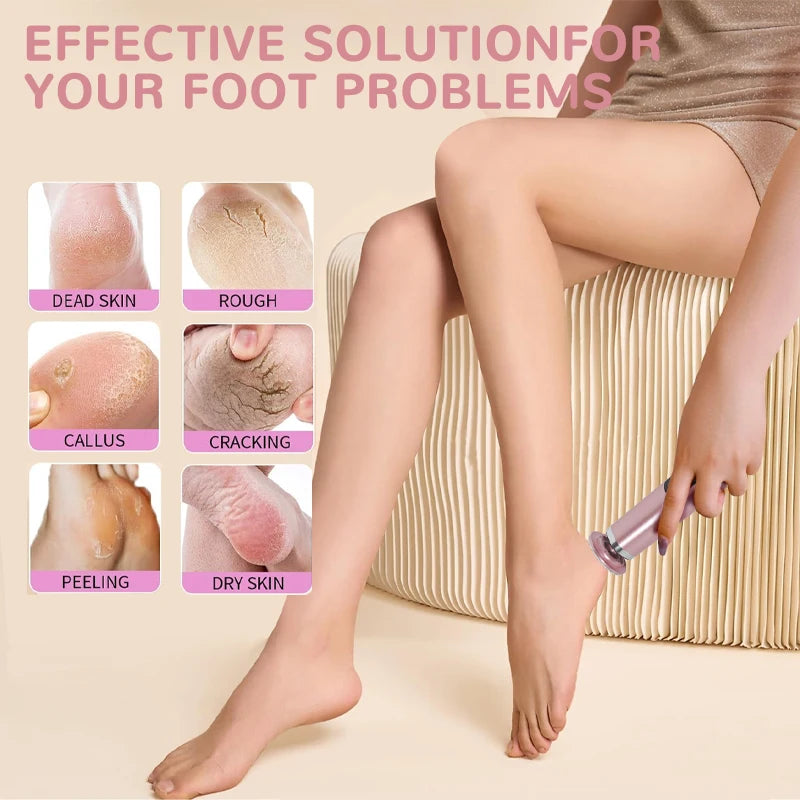 2025 Ny 2-i-1 Elektrisk Fotfil – Oppladbar Maskin for Myke og Glatte Føtter